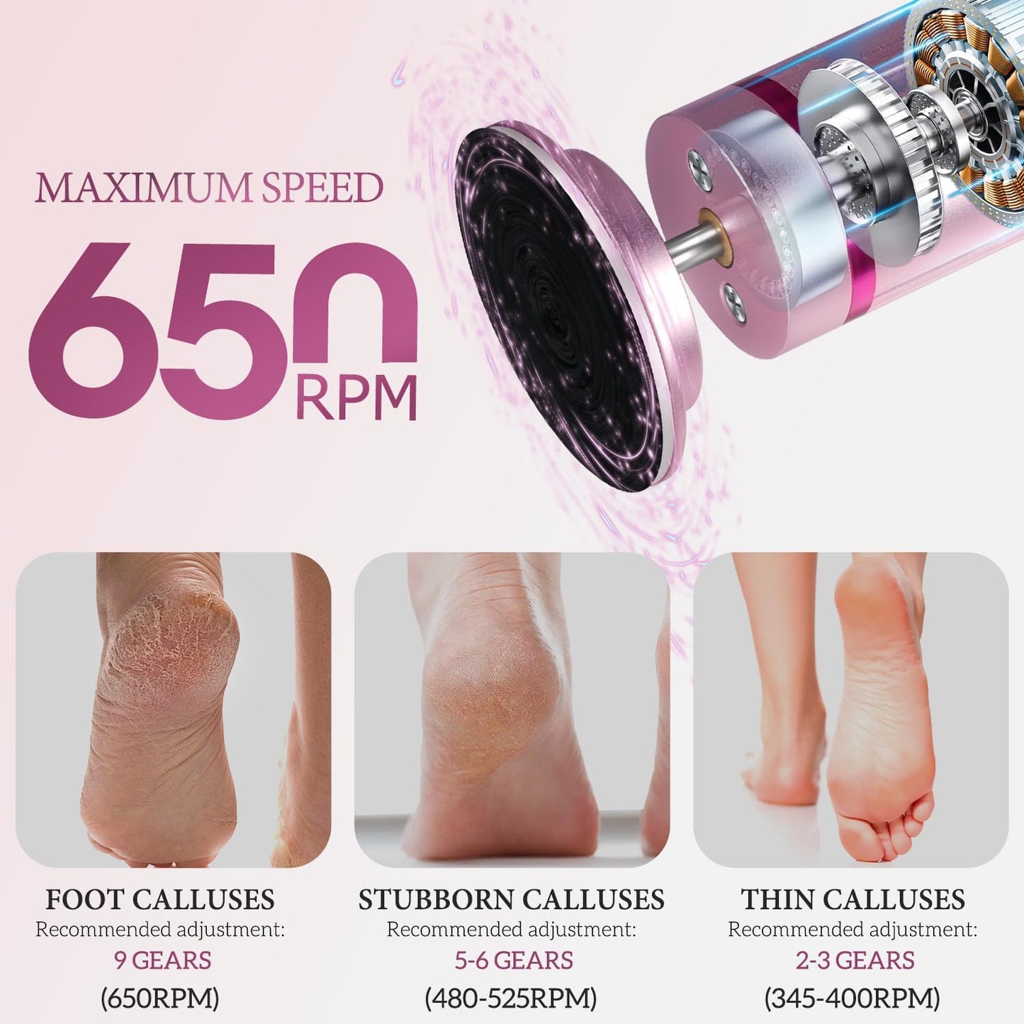 CoralBond 2-in-1 Electric Callus Foot Feet File Nail Grinder Rechargeable Remover LED Pink VB073