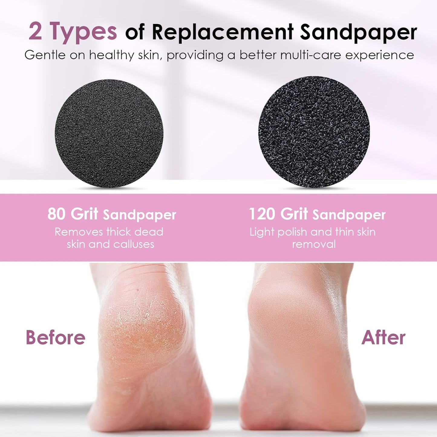 CoralBond Professional 2-in-1 Electric Foot Feet Callus Remover Rose Gold Adjustable Portable Nail File Grinder Kit VB078
