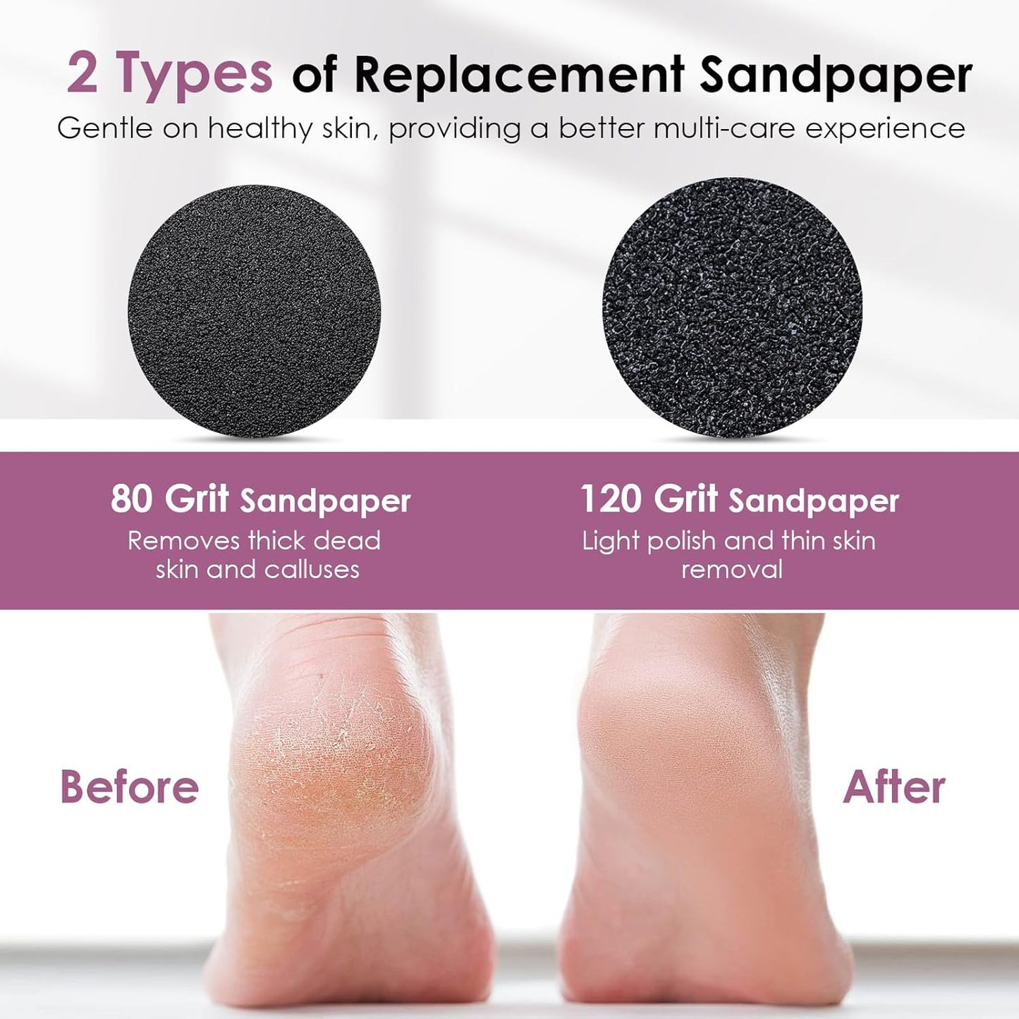 CoralBond Professional 2-in-1 Electric Foot Feet Callus Remover Silver Adjustable Portable Nail File Grinder Kit VB079