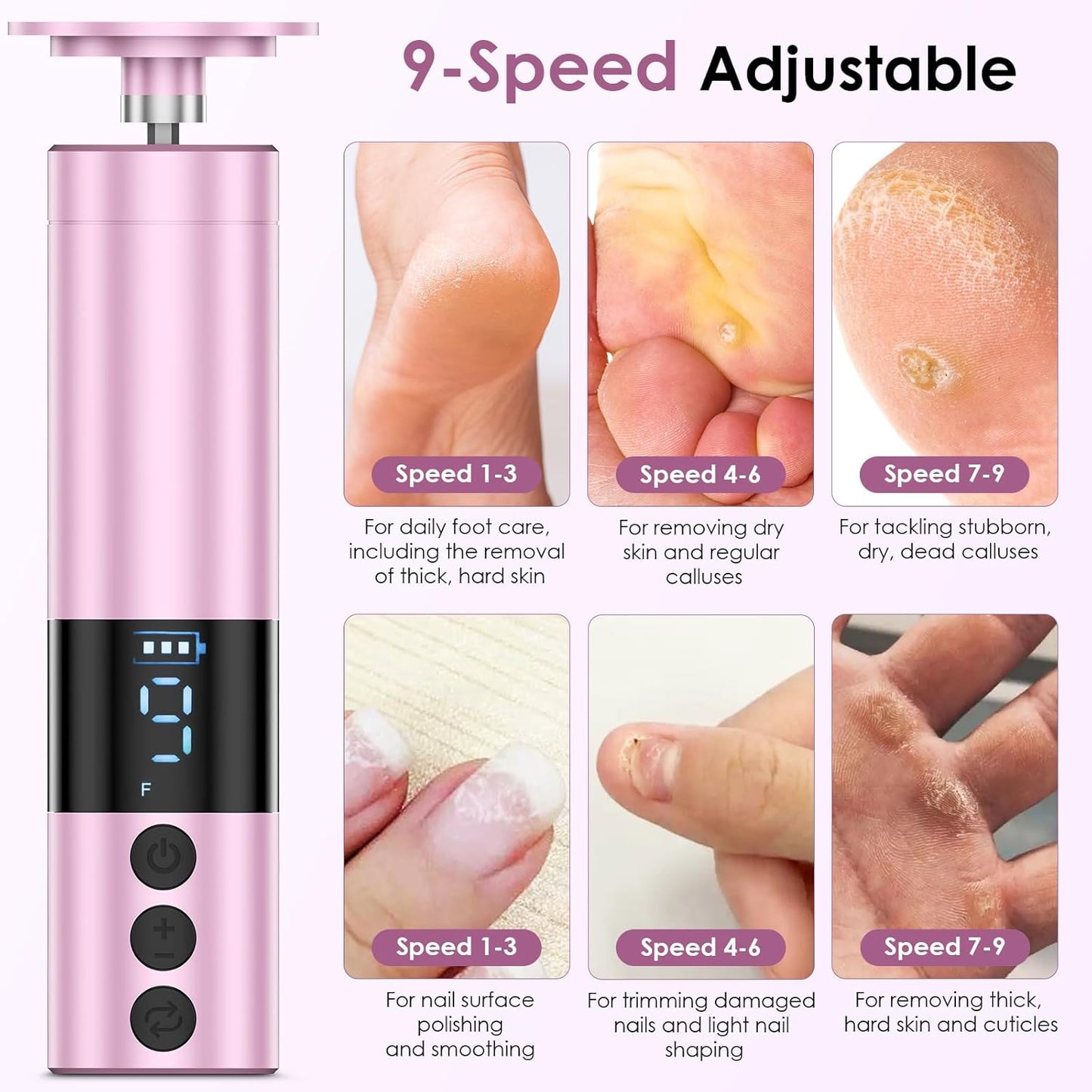 CoralBond Professional 2-in-1 Electric Foot Feet Callus Remover Rose Gold Adjustable Portable Nail File Grinder Kit VB078
