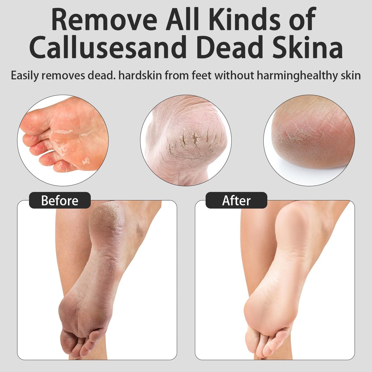 CoralBond Electric Foot Feet Callus Remover Black Rechargeable Adjustable Speed File VB074