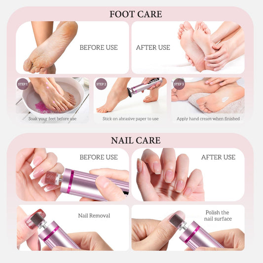 CoralBond 2-in-1 Electric Callus Foot Feet File Nail Grinder Rechargeable Remover LED Pink VB073