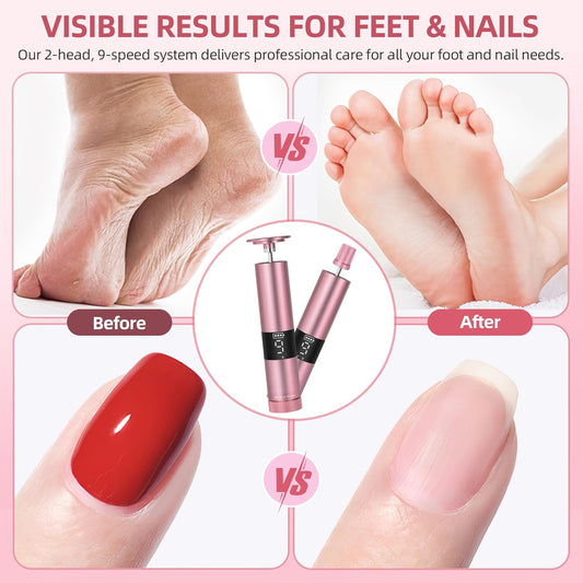 CoralBond 2-in-1 Electric Foot Feet Callus Remover Nail File Pedicure Kit Digital Screen VB077