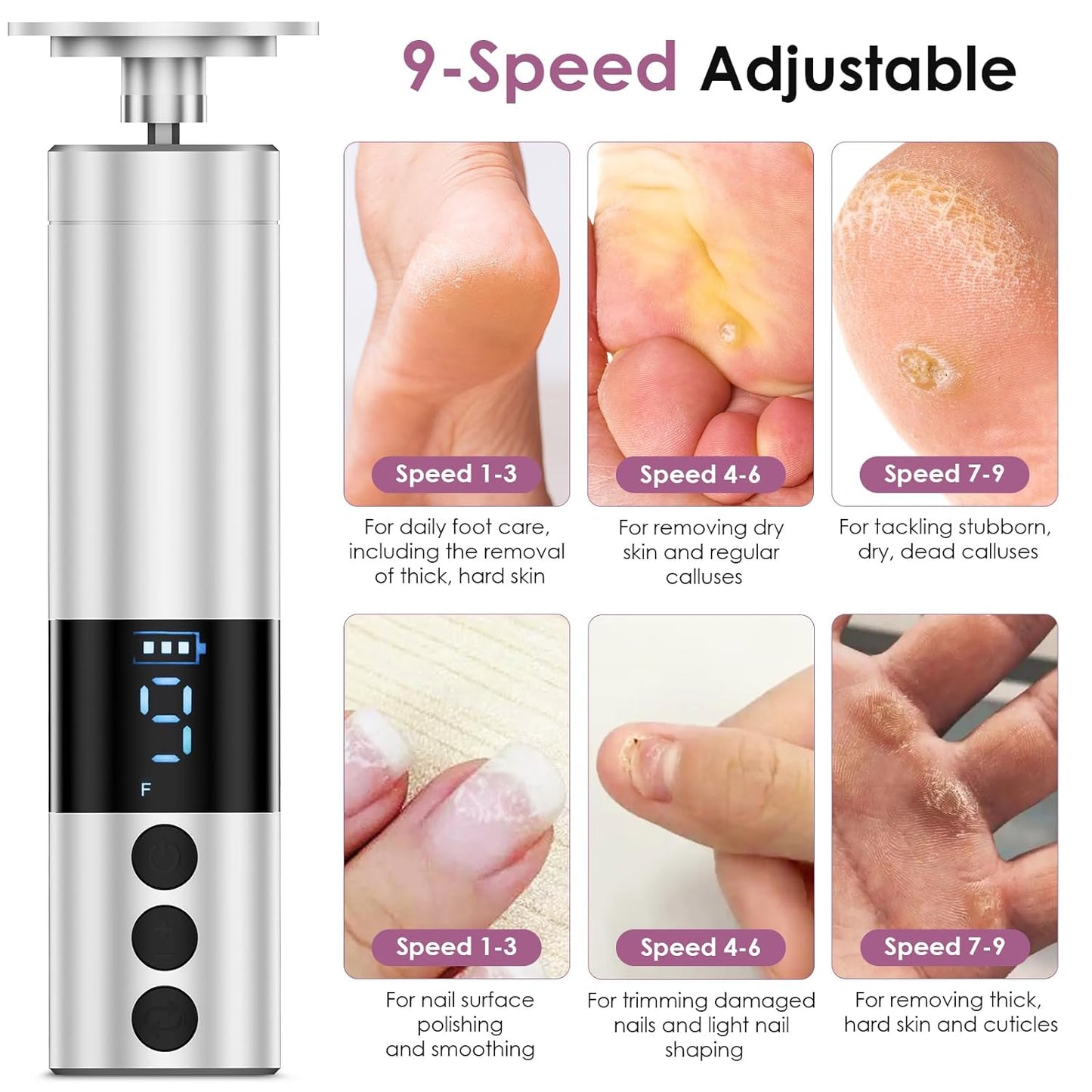 CoralBond Professional 2-in-1 Electric Foot Feet Callus Remover Silver Adjustable Portable Nail File Grinder Kit VB079