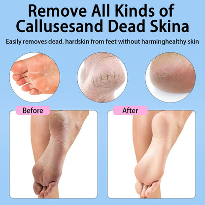 CoralBond Electric Foot Feet Callus Remover Pink Rechargeable Adjustable Speed File VB075