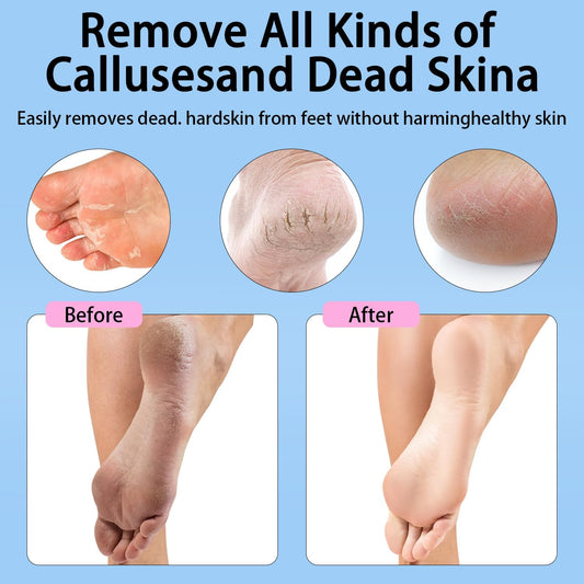 CoralBond Electric Foot Feet Callus Remover Pink Rechargeable Adjustable Speed File VB075