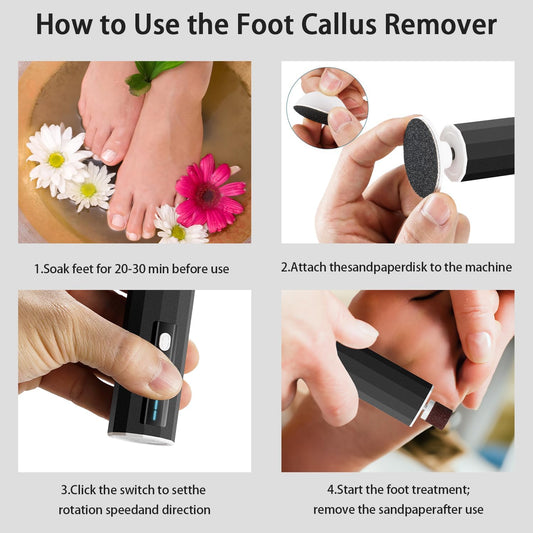 CoralBond Electric Foot Feet Callus Remover Black Rechargeable Adjustable Speed File VB074
