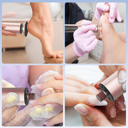 CoralBond 2-in-1 Professional Electric Foot Feet Callus Remover Rose Gold Powerful File Grinder Sander Machine Adjustable Pedicure Tool VB070