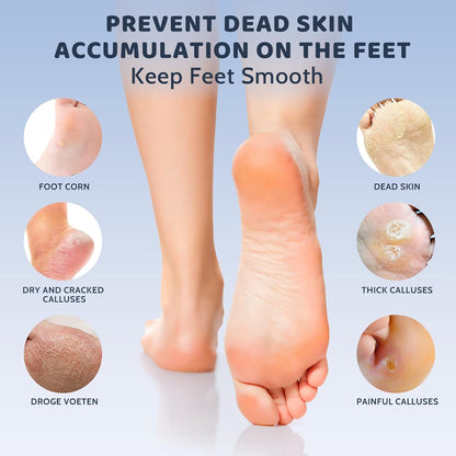 CoralBond 2-in-1 Professional Electric Foot Feet Callus Remover Rose Gold Powerful File Grinder Sander Machine Adjustable Pedicure Tool VB070